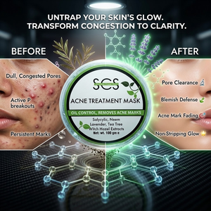 Acne treatment mask with 'SCS' branding, showing before and after effects on skin.