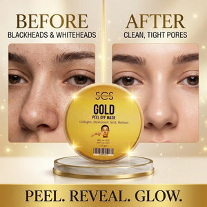 Gold peel off mask for blackheads and whiteheads – clean, tight pores