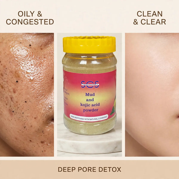 Mud mask before and after – oily congested skin to clean clear pores